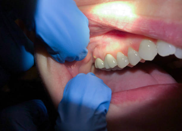 Best Urgent Dental Care for Toothaches in Merrifield, VA