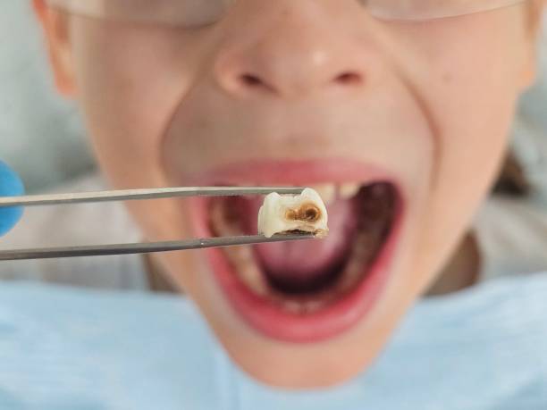 Best Emergency Denture Repair in Merrifield, VA