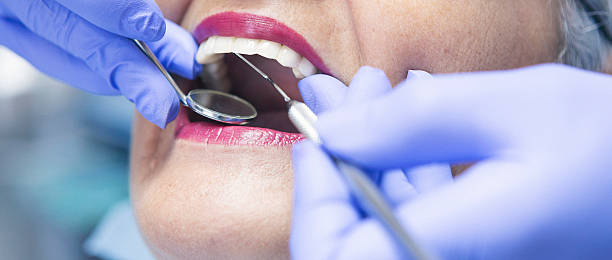 Best Emergency Root Canal Therapy in Merrifield, VA